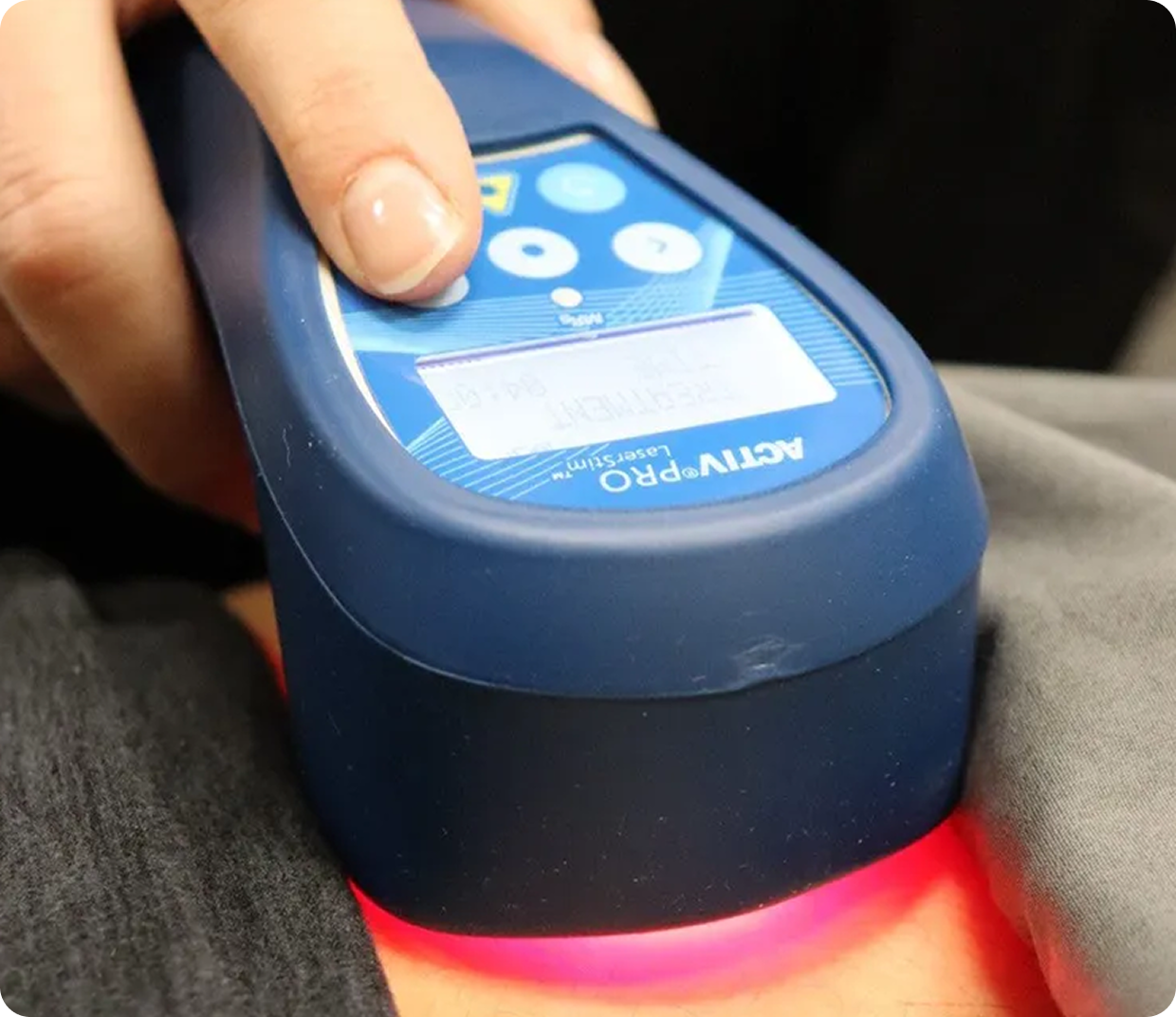 Laser treatment on person's arm