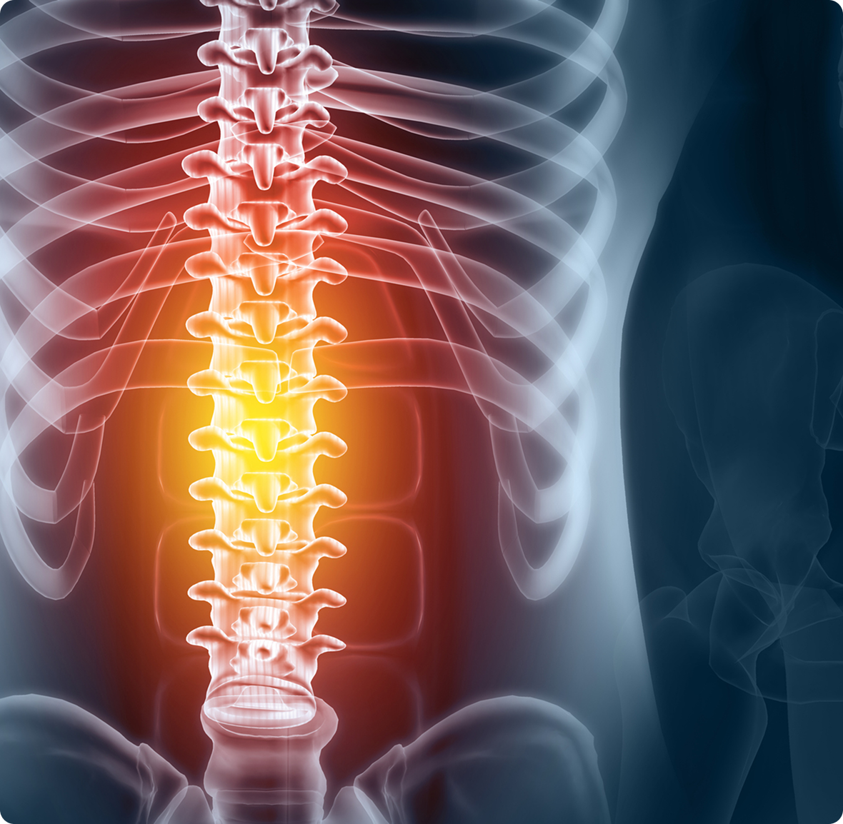 X-ray showing spine and ribs